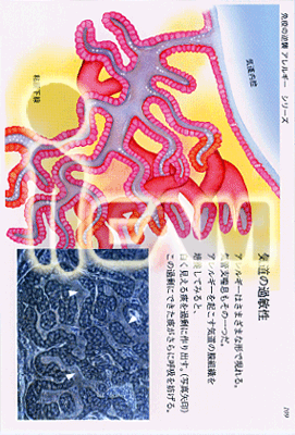 109:気道の過敏性