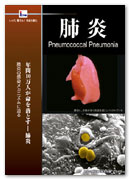 DVD/VHSux@Pneumococcal Pneumoniav