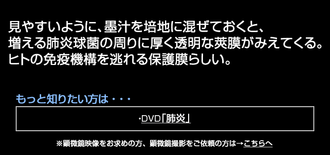 肺炎球菌の莢膜