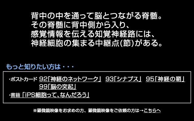 脊髄神経節