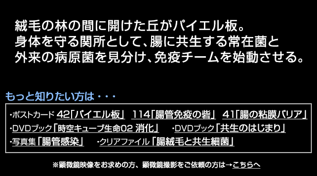 パイエル板