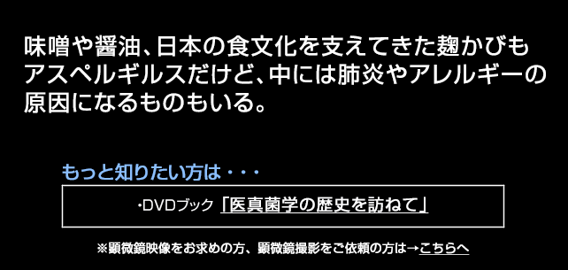アスペルギルスのコロニー