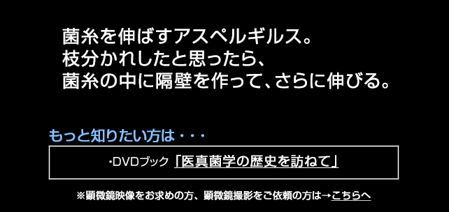 アスペルギルスの隔壁
