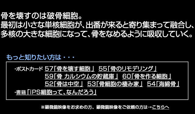 破骨細胞