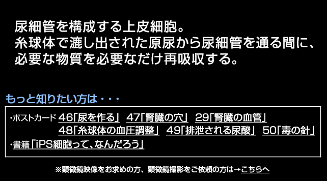 尿細管上皮